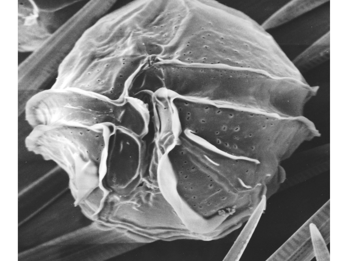Dinoflagellates: What you Can’t see can hurt&nbsp;you